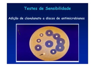 Adição de clavulanato a discos de antimicrobianos
Testes de Sensibilidade
Testes de Sensibilidade
 