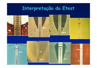 Interpreta
Interpretaç
ção do Etest
ão do Etest
 
