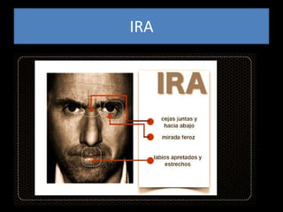 IRA
 