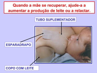 Quando a mãe se recuperar, ajude-a a
 aumentar a produção de leite ou a relactar.

                 TUBO SUPLEMENTADOR




ESPARADRAPO




                                          10

COPO COM LEITE
 