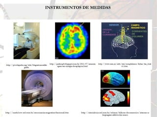 INSTRUMENTOS DE MEDIDAS


• Tomografias por Emissão de Pósitrons (TEP), que detecta os açucares
(isótopos radioativos) injetados nos pacientes para rastrear o fluxo sanguíneos no
cérebro – indicador de atividade cerebral;

• Imagens de Ressonância Magnética (IRM), que são geradas usando ondas de
radio para alterar o alinhamento dos átomos do corpo em um campo magnético;

• Imagens de Ressonância Magnéticas Funcional (IRMf), revela a atividade
cerebral medindo o fluxo sanguineo – produzem multiplas imagens por segundo;

• Magnetoencefalografia (MEG), produz até 4000 medidas magnéticas do cérebro
por segundo;

• Substâncias Químicas Neurotransmissoras.
 