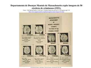 Departamento de Doenças Mentais de Massachusetts expõe imagens de 50
cérebros de criminosos (1921).
Fonte: Cold Spring Harbor, E.06 Eug-2, Exhibits Book-Second Int.Ex. Of Eugenics,pg 119.
http://www.eugenicsarchive.org/html/eugenics/static/images/567.html