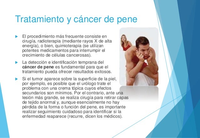 Que más rápidamente aumentar el miembro viril