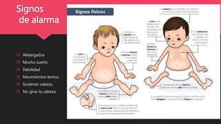 Signos
de alarma
 Aletargados
 Mucho sueño
 Debilidad
 Movimientos lentos
 Sostener cabeza
 No girar la cabeza
 