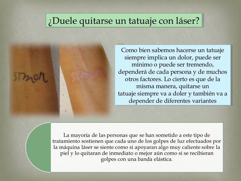 Como quitar un tatuaje