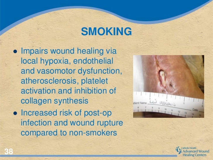 Medical Comorbidities and their impacto on wound healing