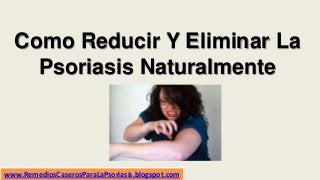 Como Reducir Y Eliminar La
Psoriasis Naturalmente
www.RemediosCaserosParaLaPsoriasis.blogspot.com
 