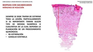 COMO SACARLE EL MEJOR PROVECHO A UNA BIOPSIA DE PIEL Reunión Sociedad Antioqueña de 
Dermatología. Octubre 2014 
BIOPSIAS CON SACABOCADOS 
MÁRGENES DE RESECCIÓN 
SIEMPRE SE DEBE TRATAR DE EXTIRPAR 
TODA LA LESIÓN, PARTICULARMENTE 
SI ES IMPORTANTE TOMAR ALGÚN 
TIPO DE MEDIDA NUMÉRICA O 
CUALITATIVA DE LA CUAL DEPENDA LA 
PLANEACIÓN DE UN PROCEDIMIENTO 
QUIRÚRGICO. 
• RE-EXTIRPACIÓN 
• GANGLIO CENTINELA 
 