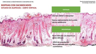 ¿QUÉ TIPO DE CORTE USAR: VERTICAL, COMO SACARLE EL MEJOR PROVECHO A UNA BIOPSIA D EH OPRIEIZLONTAL, AMBOS? Reunión Sociedad Antioqueña de 
BIOPSIAS CON SACABOCADOS 
ESTUDIO DE ALOPECIAS – CORTE VERTICAL 
VENTAJAS 
Fácil de realizar e interpretar 
Buena representación de la unión 
dermo-epidérmica 
DESVENTAJAS 
Pocos folículos y la mayoría en 
cortes oblicuos 
Difícil de estandarizar. 
No es adecuada para estudios 
cuantitativos 
Dermatología. Octubre 2014 
 