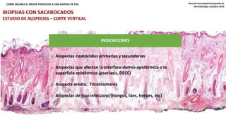 COMO SACARLE EL MEJOR PROVECHO A UNA BIOPSIA DE PIEL Reunión Sociedad Antioqueña de 
INDICACIONES 
o Alopecias cicatriciales primarias y secundarias 
o Alopecias que afectan la interface dermo-epidérmica o la 
superficie epidérmica (psoriasis, DECC) 
o Alopecia areata. Tricotilomanía 
o Alopecias de tipo infeccioso (hongos, lúes, herpes, etc) 
Dermatología. Octubre 2014 
BIOPSIAS CON SACABOCADOS 
ESTUDIO DE ALOPECIAS – CORTE VERTICAL 
 