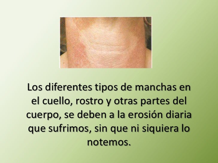 Como quitará las manchas de pigmento