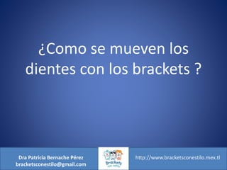 ¿Como se mueven los
dientes con los brackets ?
Dra Patricia Bernache Pérez
bracketsconestilo@gmail.com
http://www.bracketsconestilo.mex.tl
 