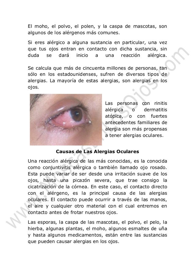 Las arrugas alrededor de los ojos arreglamos por el láser las revocaciones
