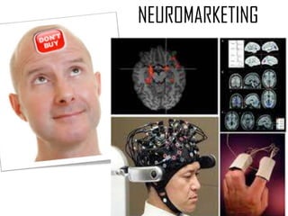 NEUROMARKETING

 