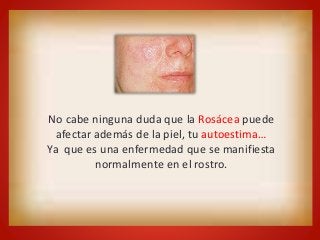 No cabe ninguna duda que la Rosácea puede 
afectar además de la piel, tu autoestima… 
Ya que es una enfermedad que se manifiesta 
normalmente en el rostro. 
 