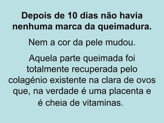 Depois de 10 dias não havia
nenhuma marca da queimadura.
    Nem a cor da pele mudou.
     Aquela parte queimada foi
    totalmente recuperada pelo
colagénio existente na clara de ovos
 que, na verdade é uma placenta e
       é cheia de vitaminas.
 