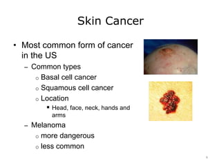 Skin Cancer
• Most common form of cancer
in the US
– Common types
o Basal cell cancer
o Squamous cell cancer
o Location
 Head, face, neck, hands and
arms
– Melanoma
o more dangerous
o less common
8
 