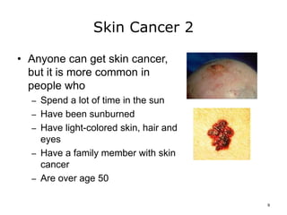 Skin Cancer 2
• Anyone can get skin cancer,
but it is more common in
people who
– Spend a lot of time in the sun
– Have been sunburned
– Have light-colored skin, hair and
eyes
– Have a family member with skin
cancer
– Are over age 50
9
 