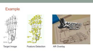 Example
Target Image Feature Detection AR Overlay
 