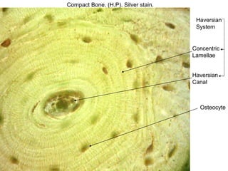 Compact Bone. (H.P). Silver stain.
Haversian
System
Haversian
Canal
Osteocyte
Concentric
Lamellae
 