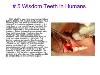 # 5 Wisdom Teeth in Humans   With all of the pain, time, and money that are put into dealing with wisdom teeth, humans have become just a little more than tired of these remnants from their large jawed ancestors. But regardless of how much they are despised, the wisdom teeth remain, and force their way into mouths regardless of the pain inflicted. There are two possible reasons why the wisdom teeth have become vestigial. The first is that the human jaw has become smaller than its ancestors? and the wisdom teeth are trying to grow into a jaw that is much too small. The second reason may have to do with dental hygiene. A few thousand years ago, it might be common for an 18 year old man to have lost several, probably most, of his teeth, and the incoming wisdom teeth would prove useful. Now that humans brush their teeth twice a day, it’s possible to keep one’s teeth for a lifetime. The drawback is that the wisdom teeth still want to come in, and when they do, they usually need to be extracted to prevent any serious pain.  