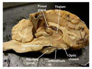 Thalam
us
Hypothalam
us
Pituitary
gland
Pineal
gland
Optic
chiasm
Infundibulu
m 12
 