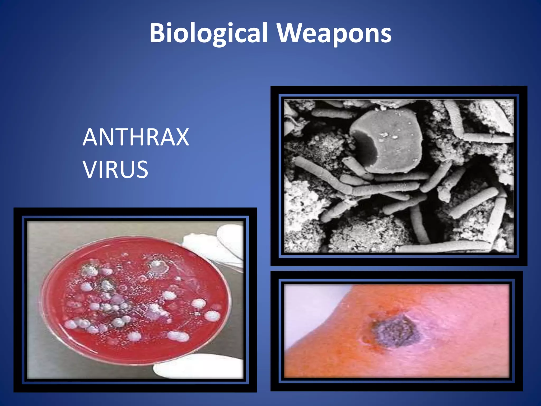 Biological Weapons
ANTHRAX
VIRUS
 