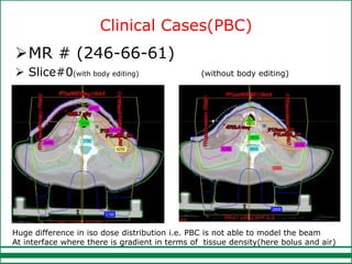 Pbc Radiographically Comparative study of aaa and pbc (1) | PPTX