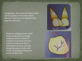 Uprighting- the crown of certain teeth
will be tipped in the mesio-distal
direction and the roots tipped in the
opposite direction
Rotation- displacement of the
body, produced by a couple,
characterized by centre of
rotation coinciding with the
centre of resistance that is
movement of point of tooth
along the area of circle with
centre of resistance being the
centre of the circle.
 