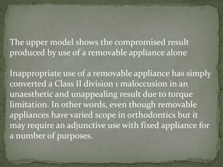The upper model shows the compromised result
produced by use of a removable appliance alone
Inappropriate use of a removable appliance has simply
converted a Class II division 1 maloccusion in an
unaesthetic and unappealing result due to torque
limitation. In other words, even though removable
appliances have varied scope in orthodontics but it
may require an adjunctive use with fixed appliance for
a number of purposes.
 