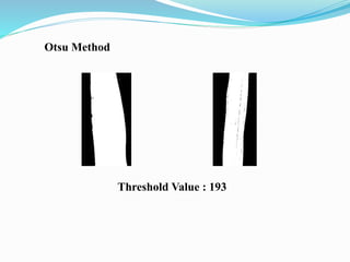 Otsu Method
Threshold Value : 193
 