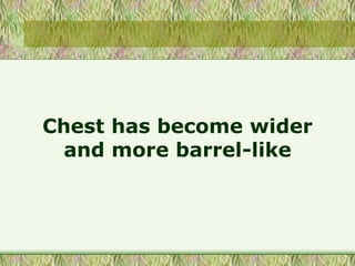 Chest has become wider
and more barrel-like
 