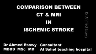 Comparison between ct mri in ischemic stroke 