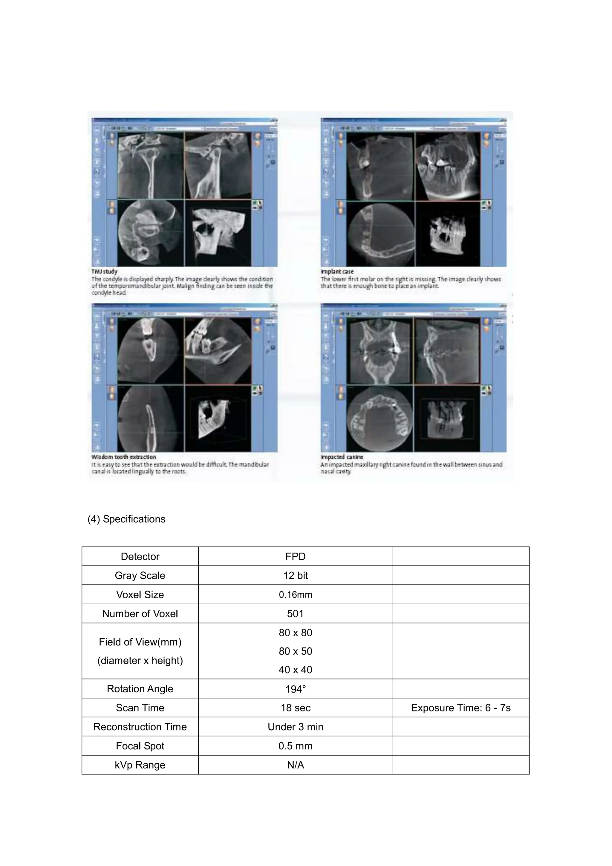 (4) Specifications
Detector FPD
Gray Scale 12 bit
Voxel Size 0.16mm
Number of Voxel 501
Field of View(mm)
(diameter x height)
80 x 80
80 x 50
40 x 40
Rotation Angle 194°
Scan Time 18 sec Exposure Time: 6 - 7s
Reconstruction Time Under 3 min
Focal Spot 0.5 mm
kVp Range N/A
 