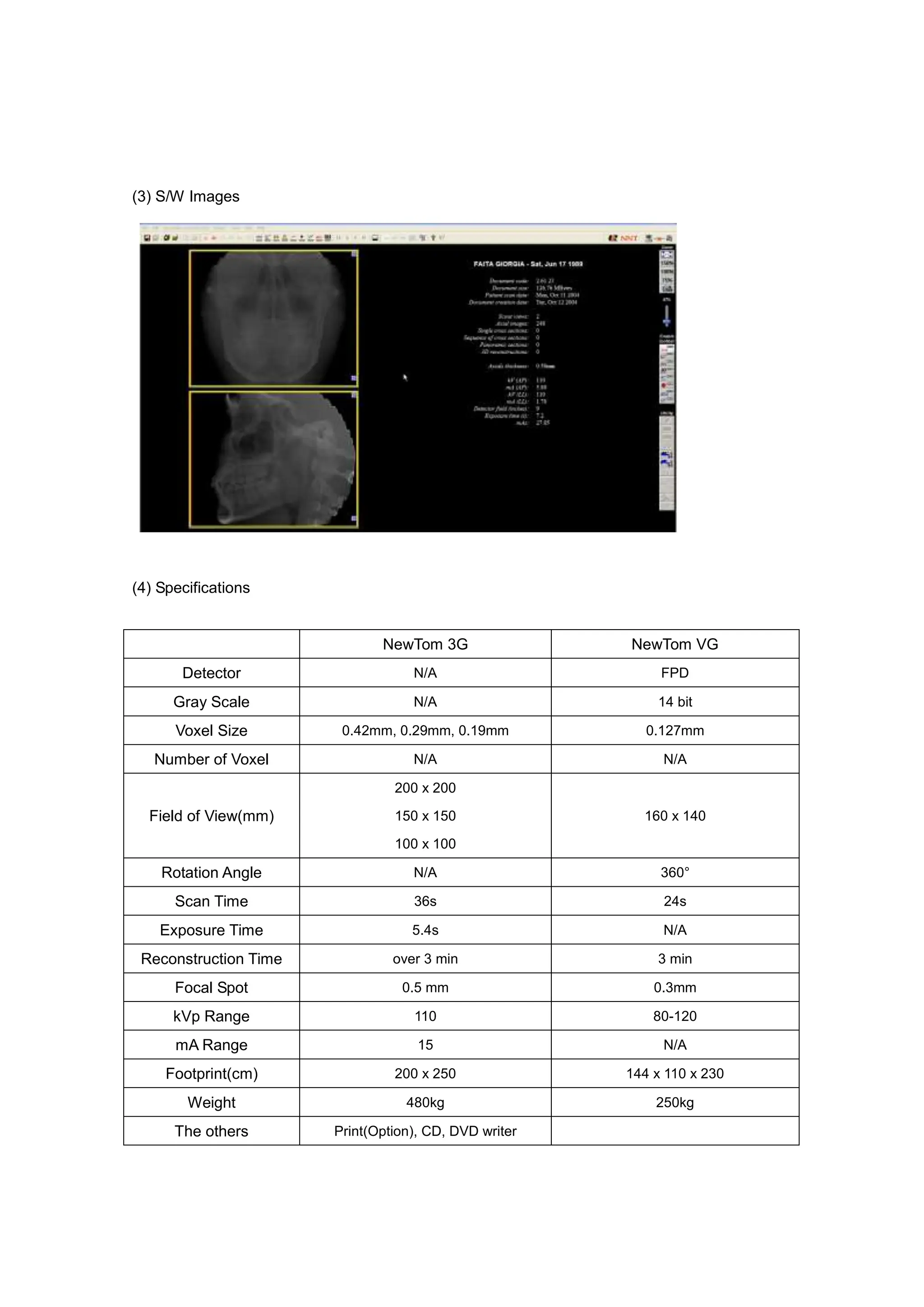 (3) S/W Images
(4) Specifications
NewTom 3G NewTom VG
Detector N/A FPD
Gray Scale N/A 14 bit
Voxel Size 0.42mm, 0.29mm, 0.19mm 0.127mm
Number of Voxel N/A N/A
Field of View(mm)
200 x 200
150 x 150
100 x 100
160 x 140
Rotation Angle N/A 360°
Scan Time 36s 24s
Exposure Time 5.4s N/A
Reconstruction Time over 3 min 3 min
Focal Spot 0.5 mm 0.3mm
kVp Range 110 80-120
mA Range 15 N/A
Footprint(cm) 200 x 250 144 x 110 x 230
Weight 480kg 250kg
The others Print(Option), CD, DVD writer
 