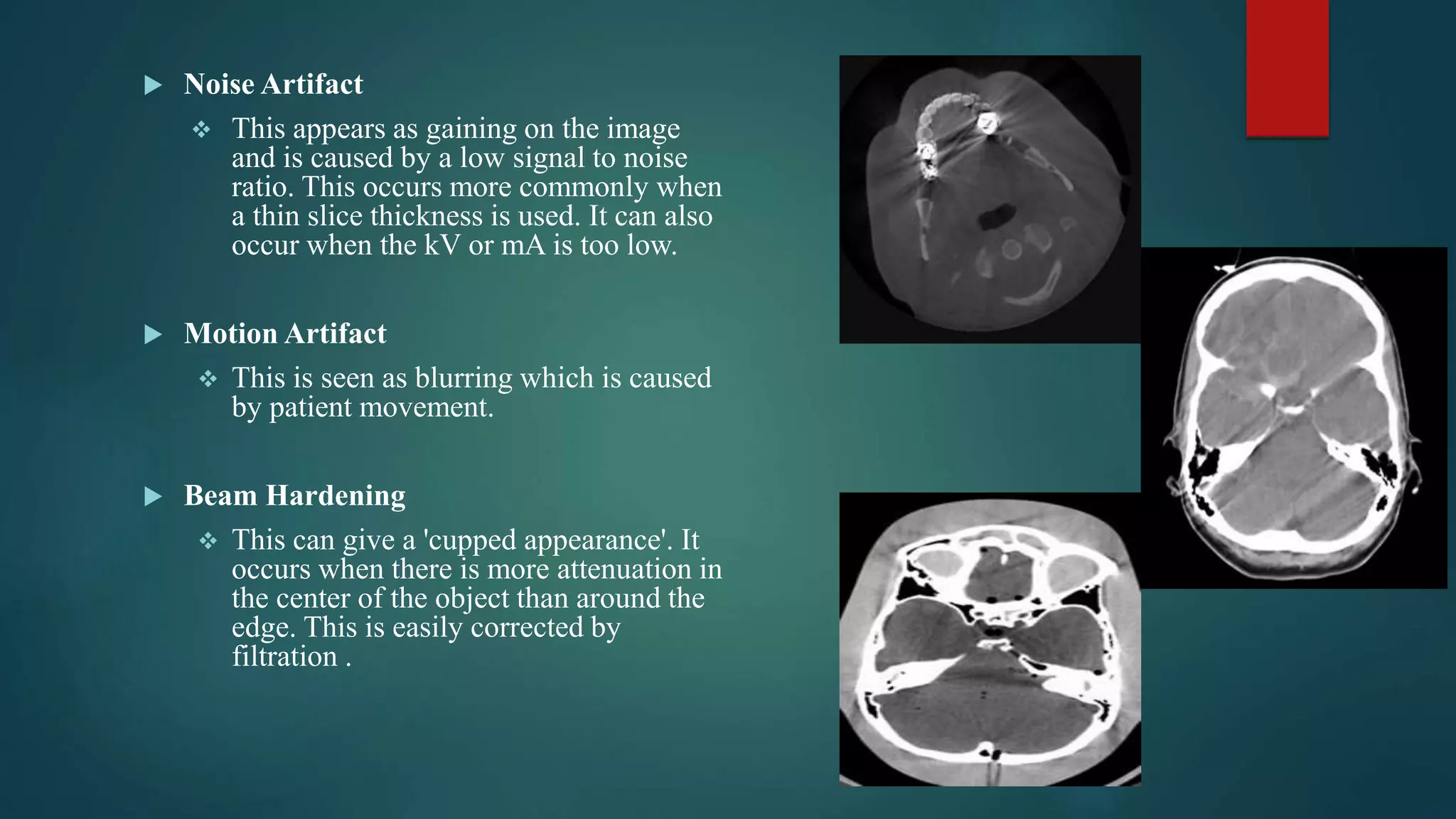 Comparison of ct and cbct | PPTX
