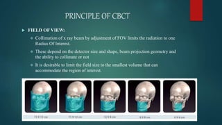 Comparison of ct and cbct | PPTX