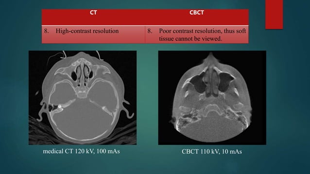 Cbct Comparison Chart : Radiation doses and risks of CBCT – RYSE