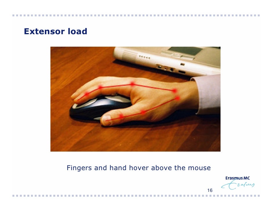 Comparison Of Ergonomic Mouse