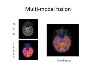 Multi-modal fusion
 