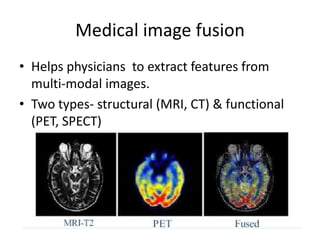 Medical image fusion
• Helps physicians to extract features from
  multi-modal images.
• Two types- structural (MRI, CT) & functional
  (PET, SPECT)
 