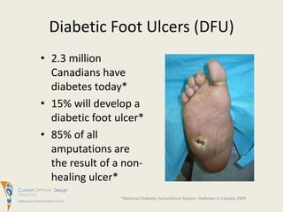 Diabetic Foot Ulcers (DFU)2.3 million Canadians have diabetes today*15% will develop a diabetic foot ulcer*85% of all amputations are the result of a non-healing ulcer**National Diabetes Surveillance System: Diabetes in Canada 2009