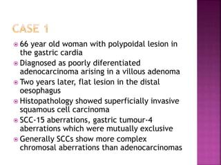  66 year old woman with polypoidal lesion in
the gastric cardia
 Diagnosed as poorly diferentiated
adenocarcinoma arising in a villous adenoma
 Two years later, flat lesion in the distal
oesophagus
 Histopathology showed superficially invasive
squamous cell carcinoma
 SCC-15 aberrations, gastric tumour-4
aberrations which were mutually exclusive
 Generally SCCs show more complex
chromosal aberrations than adenocarcinomas
 