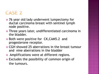  76 year old lady underwent lumpectomy for
ductal carcinoma breast with sentinel lymph
node positive.
 Three years later, undifferentiated carcinoma in
the bladder.
 Both were positive for CK,CAM5.2 and
progesterone receptor.
 CGH showed 25 aberrations in the breast tumour
and nine aberrations in the bladder
 Amplifications were at different regions.
 Excludes the possibility of common origin of
the tumours.
 