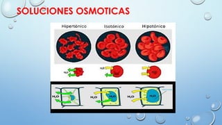 SOLUCIONES OSMOTICAS
 