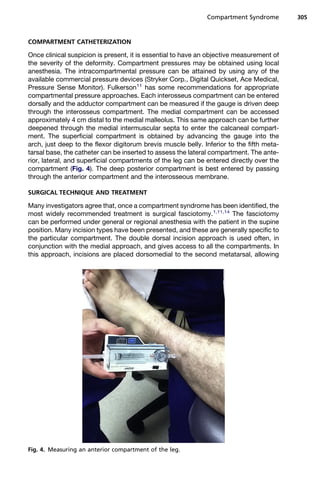 Compartment Syndrome         305



COMPARTMENT CATHETERIZATION

Once clinical suspicion is present, it is essential to have an objective measurement of
the severity of the deformity. Compartment pressures may be obtained using local
anesthesia. The intracompartmental pressure can be attained by using any of the
available commercial pressure devices (Stryker Corp., Digital Quickset, Ace Medical,
Pressure Sense Monitor). Fulkerson11 has some recommendations for appropriate
compartmental pressure approaches. Each interosseus compartment can be entered
dorsally and the adductor compartment can be measured if the gauge is driven deep
through the interosseus compartment. The medial compartment can be accessed
approximately 4 cm distal to the medial malleolus. This same approach can be further
deepened through the medial intermuscular septa to enter the calcaneal compart-
ment. The superficial compartment is obtained by advancing the gauge into the
arch, just deep to the flexor digitorum brevis muscle belly. Inferior to the fifth meta-
tarsal base, the catheter can be inserted to assess the lateral compartment. The ante-
rior, lateral, and superficial compartments of the leg can be entered directly over the
compartment (Fig. 4). The deep posterior compartment is best entered by passing
through the anterior compartment and the interosseous membrane.

SURGICAL TECHNIQUE AND TREATMENT

Many investigators agree that, once a compartment syndrome has been identified, the
most widely recommended treatment is surgical fasciotomy.1,11,14 The fasciotomy
can be performed under general or regional anesthesia with the patient in the supine
position. Many incision types have been presented, and these are generally specific to
the particular compartment. The double dorsal incision approach is used often, in
conjunction with the medial approach, and gives access to all the compartments. In
this approach, incisions are placed dorsomedial to the second metatarsal, allowing




Fig. 4. Measuring an anterior compartment of the leg.
 