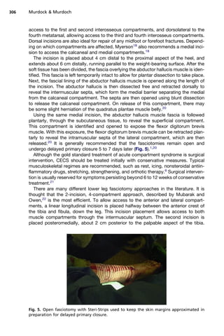 306   Murdock  Murdoch



      access to the first and second interosseous compartments, and dorsolateral to the
      fourth metatarsal, allowing access to the third and fourth interosseus compartments.
      Dorsal incisions are also ideal for repair of any midfoot or forefoot fractures. Depend-
      ing on which compartments are affected, Myerson18 also recommends a medial inci-
      sion to access the calcaneal and medial compartments.18
          The incision is placed about 4 cm distal to the proximal aspect of the heel, and
      extends about 6 cm distally, running parallel to the weight-bearing surface. After the
      soft tissue has been divided, the fascia overlying the abductor hallucis muscle is iden-
      tified. This fascia is left temporarily intact to allow for plantar dissection to take place.
      Next, the fascial lining of the abductor hallucis muscle is opened along the length of
      the incision. The abductor hallucis is then dissected free and retracted dorsally to
      reveal the intermuscular septa, which form the medial barrier separating the medial
      from the calcaneal compartment. The septa are then opened using blunt dissection
      to release the calcaneal compartment. On release of this compartment, there may
      be some slight herniation of the quadratus plantae muscle belly.20
          Using the same medial incision, the abductor hallucis muscle fascia is followed
      plantarly, through the subcutaneous tissue, to reveal the superficial compartment.
      This compartment is identified and opened to expose the flexor digitorum brevis
      muscle. With this exposure, the flexor digitorum brevis muscle can be retracted plan-
      tarly to reveal the intramuscular septa of the lateral compartment, which are then
      released.20 It is generally recommended that the fasciotomies remain open and
      undergo delayed primary closure 5 to 7 days later (Fig. 5).1,20
          Although the gold standard treatment of acute compartment syndrome is surgical
      intervention, CECS should be treated initially with conservative measures. Typical
      musculoskeletal regimes are recommended, such as rest, icing, nonsteroidal antiin-
      flammatory drugs, stretching, strengthening, and orthotic therapy.6 Surgical interven-
      tion is usually reserved for symptoms persisting beyond 6 to 12 weeks of conservative
      treatment.21
          There are many different lower leg fasciotomy approaches in the literature. It is
      thought that the 2-incision, 4-compartment approach, described by Mubarak and
      Owen,22 is the most efficient. To allow access to the anterior and lateral compart-
      ments, a linear longitudinal incision is placed halfway between the anterior crest of
      the tibia and fibula, down the leg. This incision placement allows access to both
      muscle compartments through the intermuscular septum. The second incision is
      placed posteromedially, about 2 cm posterior to the palpable aspect of the tibia.




      Fig. 5. Open fasciotomy with Steri-Strips used to keep the skin margins approximated in
      preparation for delayed primary closure.
 