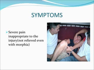 SYMPTOMS Severe pain inappropriate to the injury(not relieved even with morphia) 