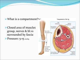 What is a compartment? Closed area of muscles group, nerves & bl.vs surrounded by fascia Pressure: 5-15  mmhg 