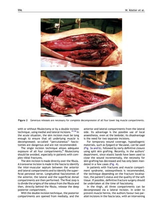 996                                                                                            W. Kostler et al.
                                                                                                   ¨




Figure 2   Generous releases are necessary for complete decompression of all four lower leg muscle compartments.


with or without ﬁbulectomy or by a double incision        anterior and lateral compartments from the lateral
technique, using medial and lateral incisions.19,30 In    side. Its advantage is the possible use of local
the acute situation, the skin incision must be long       anaesthesia, even at the bedside; its disadvantage
enough to ensure that all underlying muscle is            is the need for two separate incisions.
decompressed; so-called ‘‘percutaneous’’ fascio-             For temporary wound coverage, hypoallogenic
tomies are dangerous and are not recommended.             materials, such as Epigard or Vacuseal, can be used
   The single incision technique allows adequate          (Fig. 3a and b), followed by early deﬁnitive closure
exposure of all four compartments;8 ﬁbulectomy            using split skin grafting. Recently, in the authors’
should be avoided, especially in patients with com-       department, since elastic bands have been used to
plex tibial fractures.                                    close the wound incrementally, the necessity for
   The skin incision is made directly over the ﬁbula.     skin grafting has decreased and has only been man-
A transverse incision is made in the fascia to identify   dated in a few cases (Fig. 4).
the inter-muscular septum between the anterior               In patients with fractures and muscle compart-
and lateral compartments and to identify the super-       ment syndrome, osteosynthesis is recommended,
ﬁcial peroneal nerve. Longitudinal fasciotomies of        the technique depending on the fracture localisa-
the anterior, the lateral and the superﬁcial dorsal       tion, the patient’s status and the quality of the soft
compartments are then performed. The ﬁnal step is         tissue. If possible, deﬁnitive fracture surgery should
to divide the origins of the soleus from the ﬁbula and    be undertaken at the time of fasciotomy.
then, directly behind the ﬁbula, release the deep            In the thigh, all three compartments can be
posterior compartment.                                    decompressed via a lateral incision. In order to
   With the double incision technique, the posterior      prevent muscle hernia, the authors favour two par-
compartments are opened from medially, and the            allel incisions in the fascia lata, with an intervening
 